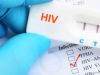 Dezembro Vermelho chama a atenção para prevenção e combate ao HIV/Aids(Foto: Getty Image)