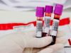 São Gonçalo: homem pode ter morrido em decorrência da gripe H1N1(Divulgao)