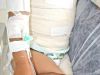 Mais de 40% das queimaduras graves registradas neste ano foram causadas por álcool(Foto: Divulgao/Fhemig)